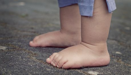 Opuchnięta noga może doprowadzić do śmierci?